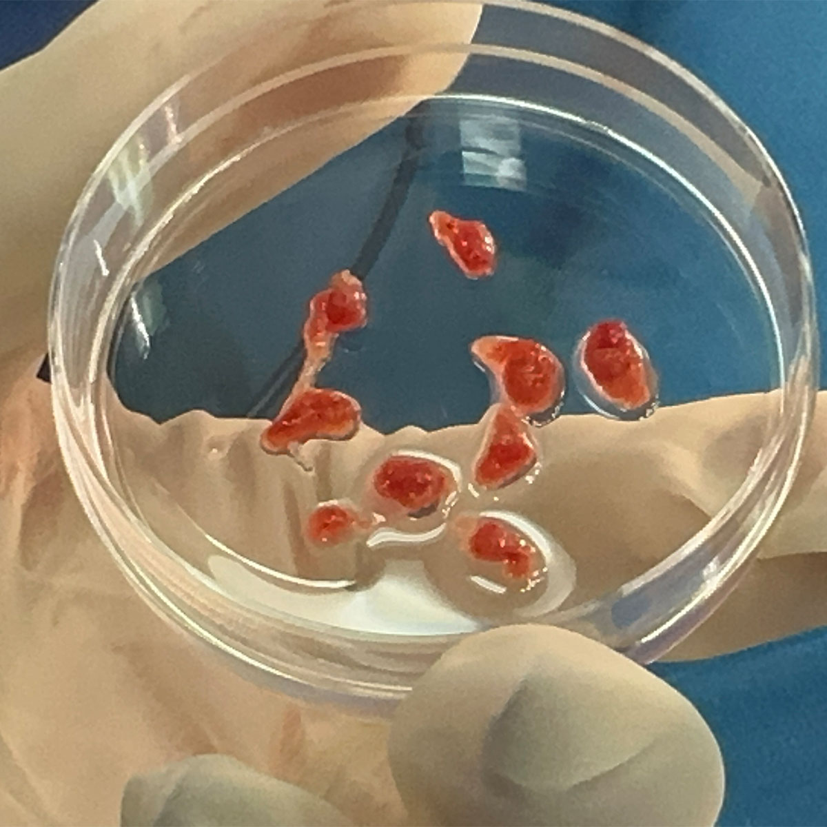 Frammenti di parenchima testicolare prelevati